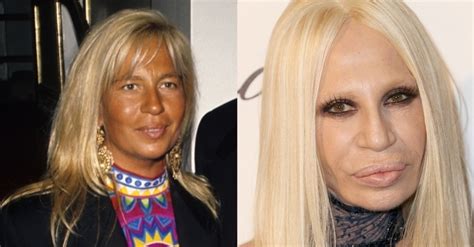 donatela versace antes e depois|Donatella Versace 90s.